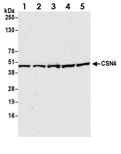 Western blot - Anti-CSN4 antibody (AB12322)