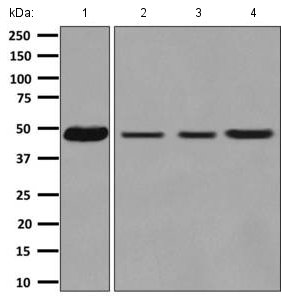 Western blot - Anti-CSN4 antibody [EPR7453] (AB139688)