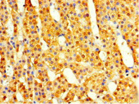 Immunohistochemistry (Formalin/PFA-fixed paraffin-embedded sections) - Anti-CSN7A antibody (AB235400)