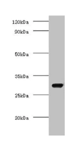 Western blot - Anti-CSN7A antibody (AB235400)