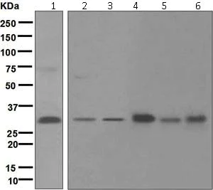 Western blot - Anti-CSN7A antibody [EPR6463] (AB124705)