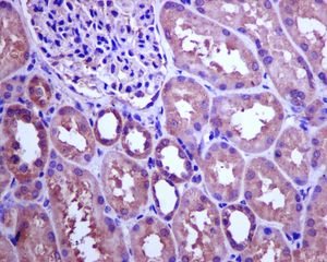 Immunohistochemistry (Formalin/PFA-fixed paraffin-embedded sections) - Anti-CSN7b antibody [EPR6464] (AB133548)