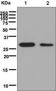 Western blot - Anti-CSN7b antibody [EPR6464] (AB133548)