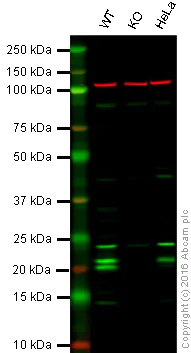 Western blot - Anti-CSN7b antibody [EPR6464] (AB133548)