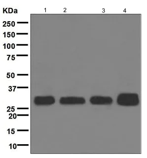 Western blot - Anti-CSN7b antibody [EPR6465] (AB124718)
