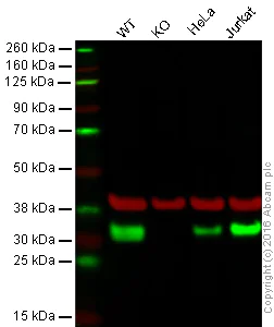 Western blot - Anti-CSN7b antibody [EPR6465] (AB124718)