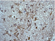 Immunohistochemistry (Formalin/PFA-fixed paraffin-embedded sections) - Anti-CSN8 antibody [EPR5139] (AB124779)