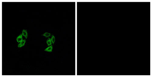 Immunocytochemistry/ Immunofluorescence - Anti-CSNK1A1 + CSNK1A1L antibody (AB196684), expandable thumbnail