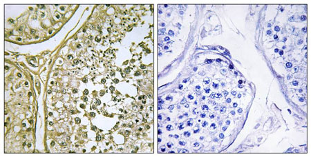 Immunohistochemistry (Formalin/PFA-fixed paraffin-embedded sections) - Anti-CSNK1A1 + CSNK1A1L antibody (AB196684), expandable thumbnail