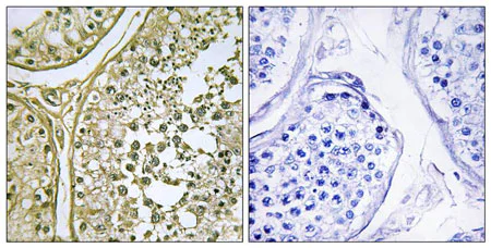 Immunohistochemistry (Formalin/PFA-fixed paraffin-embedded sections) - Anti-CSNK1A1 + CSNK1A1L antibody (AB196684)