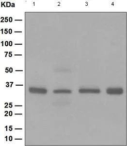 Western blot - Anti-CSNK1A1 + CSNK1A1L antibody [EPR1961(2)] (AB108296)