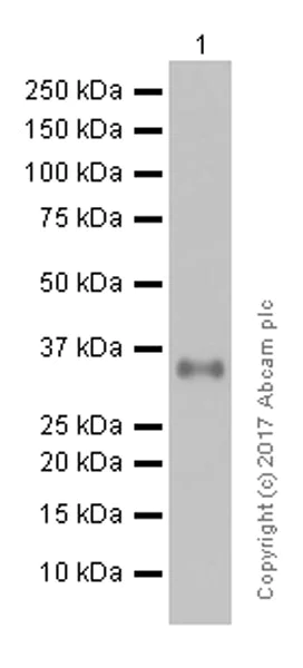 Western blot - Anti-CSNK1A1 + CSNK1A1L antibody [EPR1961(2)] (AB108296)
