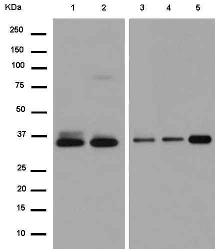 Western blot - Anti-CSNK1A1L antibody [EPR13684] - BSA and Azide free (AB250193)