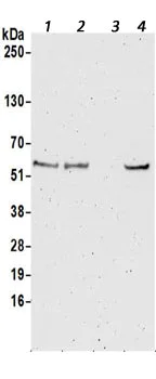 Western blot - Anti-CSNK1G1 antibody (AB190260)