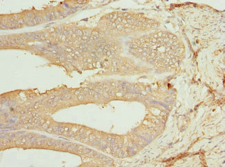 Immunohistochemistry (Formalin/PFA-fixed paraffin-embedded sections) - Anti-CSNK1G1 antibody (AB234727)