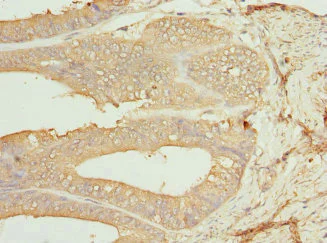 Immunohistochemistry (Formalin/PFA-fixed paraffin-embedded sections) - Anti-CSNK1G1 antibody (AB234727)
