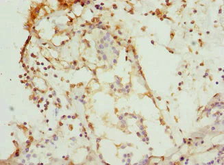 Immunohistochemistry (Formalin/PFA-fixed paraffin-embedded sections) - Anti-CSNK1G1 antibody (AB234727)