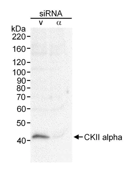 Western blot - Anti-CSNK2A1 antibody (AB10466)
