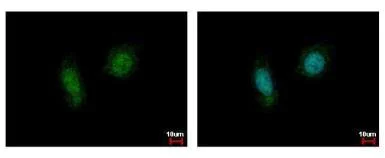 Immunocytochemistry/ Immunofluorescence - Anti-CSNK2A1 antibody (AB137788)