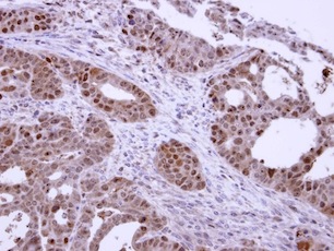 Immunohistochemistry (Formalin/PFA-fixed paraffin-embedded sections) - Anti-CSNK2A1 antibody (AB137788)