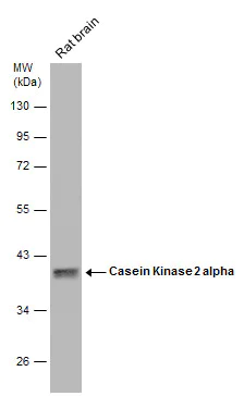 Western blot - Anti-CSNK2A1 antibody (AB137788)