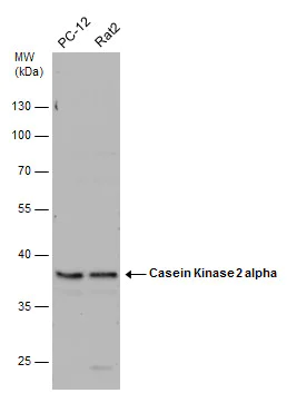 Western blot - Anti-CSNK2A1 antibody (AB137788)