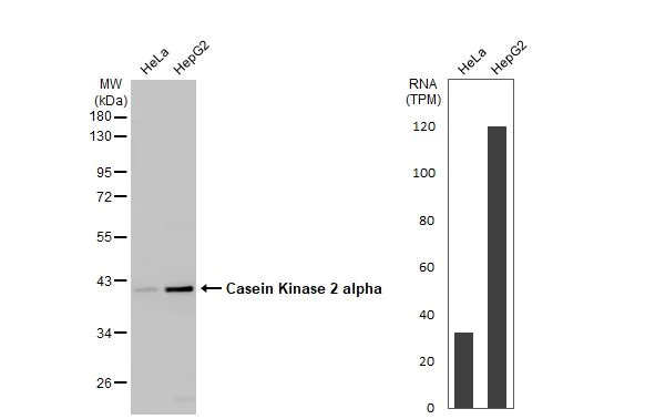 Western blot - Anti-CSNK2A1 antibody (AB137788)