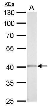 Western blot - Anti-CSNK2A1 antibody (AB137788)