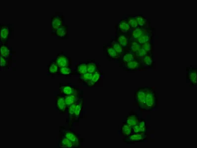 Immunocytochemistry/ Immunofluorescence - Anti-CSNK2A1 antibody (AB236664)