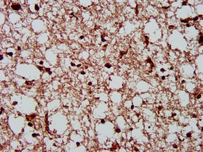 Immunohistochemistry (Formalin/PFA-fixed paraffin-embedded sections) - Anti-CSNK2A1 antibody (AB236664)