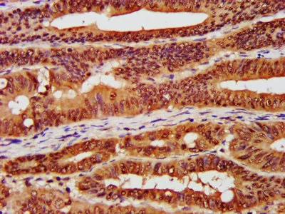 Immunohistochemistry (Formalin/PFA-fixed paraffin-embedded sections) - Anti-CSNK2A1 antibody (AB236664)