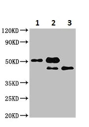 Immunoprecipitation - Anti-CSNK2A1 antibody (AB236664)