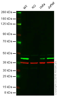 Western blot - Anti-CSNK2A1 antibody [EP1963Y] (AB76040)