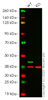 Western blot - Anti-CSNK2A1 antibody [EP1963Y] (AB76040)