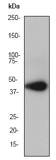 Western blot - Anti-CSNK2A1 antibody [EP1963Y] (AB76040)