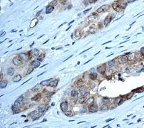 Immunohistochemistry (Formalin/PFA-fixed paraffin-embedded sections) - Anti-CSNK2A1 antibody [EP1963Y] - BSA and Azide free (AB239873)