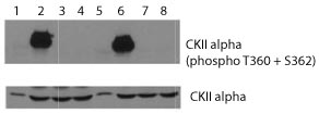 Western blot - Anti-CSNK2A1 (phospho T360 + S362) antibody (AB119410)