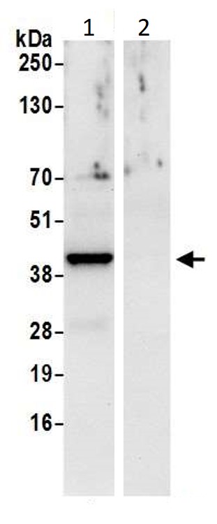 Immunoprecipitation - Anti-CSNK2A2 antibody (AB10474), expandable thumbnail