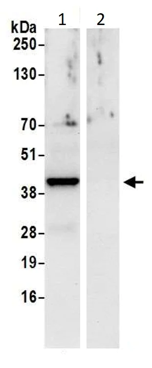 Immunoprecipitation - Anti-CSNK2A2 antibody (AB10474)