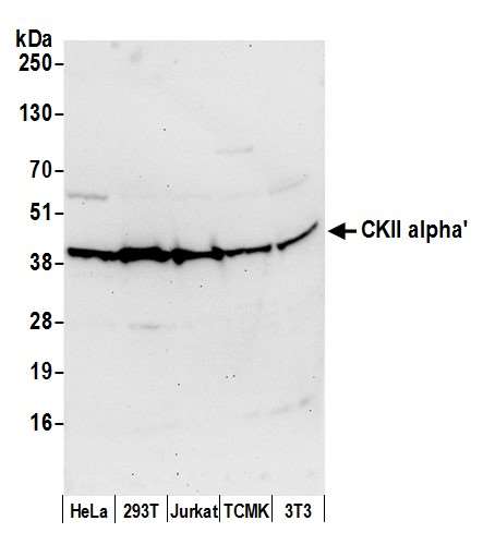 Western blot - Anti-CSNK2A2 antibody (AB10474), expandable thumbnail