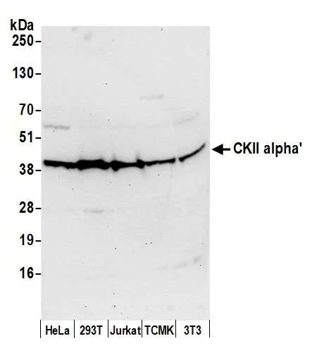 Western blot - Anti-CSNK2A2 antibody (AB10474)