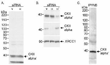 Western blot - Anti-CSNK2A2 antibody (AB10474), expandable thumbnail
