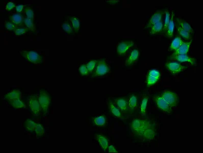 Immunocytochemistry/ Immunofluorescence - Anti-CSNK2A2 antibody (AB238728)