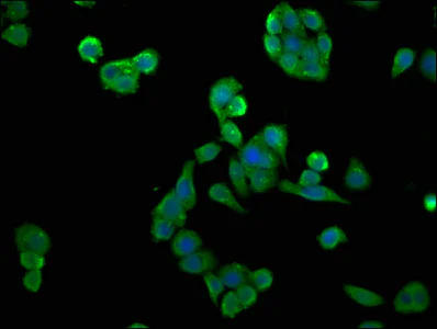 Immunocytochemistry/ Immunofluorescence - Anti-CSNK2A2 antibody (AB238728)