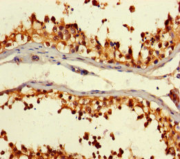 Immunohistochemistry (Formalin/PFA-fixed paraffin-embedded sections) - Anti-CSNK2A2 antibody (AB238728)