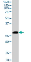 Western blot - Anti-CSP antibody (AB89236)