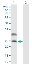 Western blot - Anti-CSP antibody (AB89236)