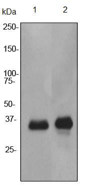 Western blot - Anti-CSPS/STM antibody [EPR3719] (AB92476)