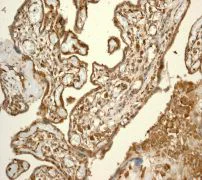 Immunohistochemistry (Formalin/PFA-fixed paraffin-embedded sections) - Anti-CSPS/STM antibody [EPR3720(2)] (AB108401)