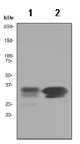 Western blot - Anti-CSPS/STM antibody [EPR3720(2)] (AB108401)